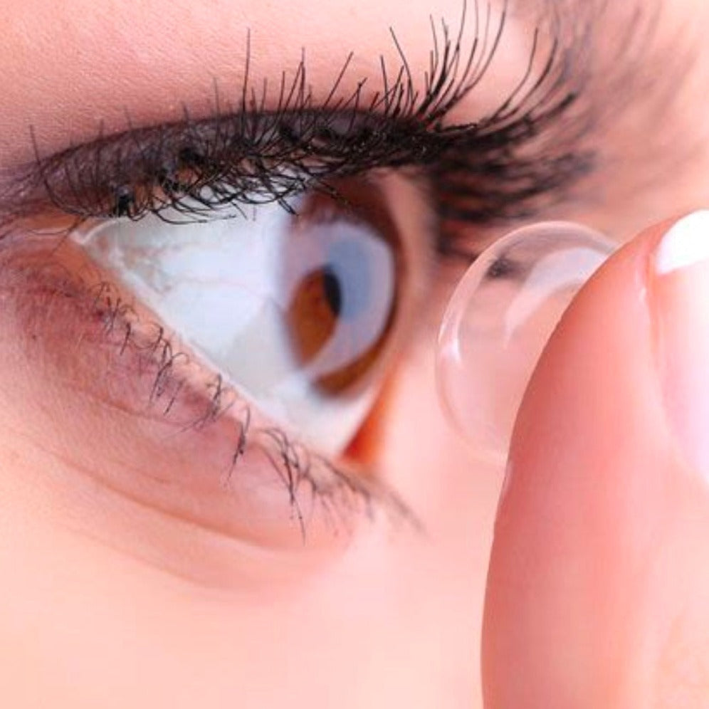 Clear Lens โ Urban Layer